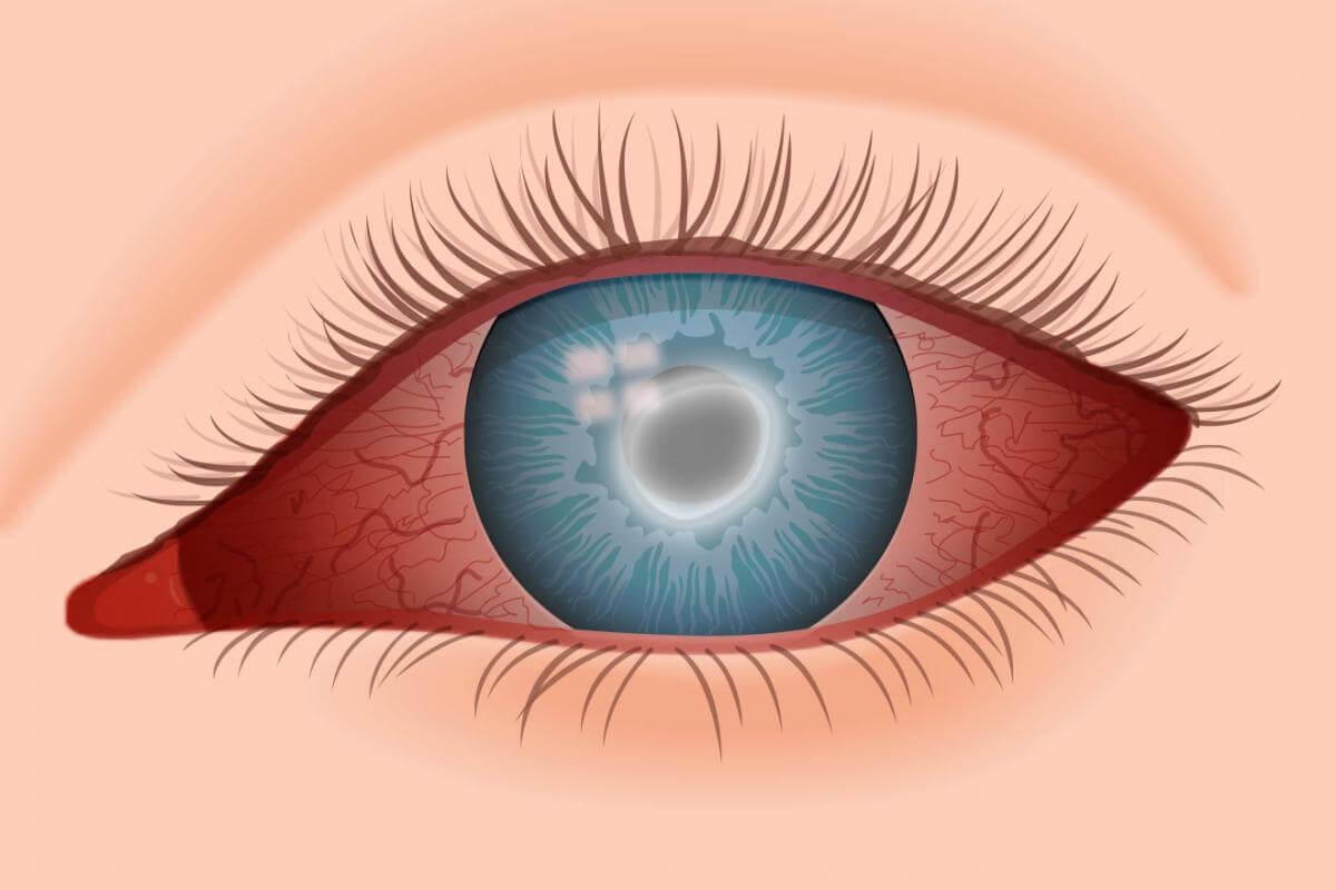 Глазные заболевания у человека: список, симптоматика